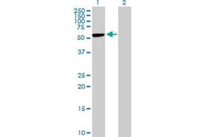 Western Blot analysis of CBS expression in transfected 293T cell line by CBS MaxPab polyclonal antibody. (CBS anticorps  (AA 1-551))