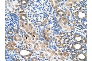 SLC22A7 antibody was used for immunohistochemistry at a concentration of 4-8 ug/ml to stain Epithelial cells of renal tubule (arrows) in Human Kidney. (SLC22A7 anticorps)