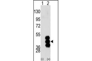 Western blot analysis of PHKG2 (arrow) using PHKG2 Antibody (N-term) (ABIN391341 and ABIN2841365). (PHKG2 anticorps  (N-Term))