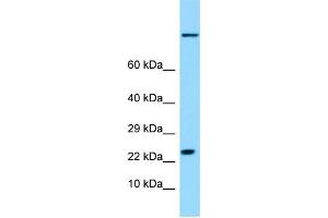 WB Suggested Anti-HSPB9 Antibody Titration: 1. (HSPB9 anticorps  (Middle Region))