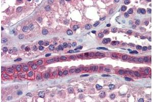 Human Kidney (formalin-fixed, paraffin-embedded) stained with SSX2IP antibody ABIN462255 followed by biotinylated goat anti-rabbit IgG secondary antibody ABIN481713, alkaline phosphatase-streptavidin and chromogen.