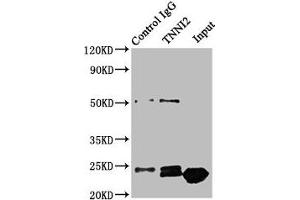 Immunoprecipitating TNNI2 in Mouse skeletal muscle tissue Lane 1: Rabbit control IgG instead of ABIN7173581 in Mouse skeletal muscle tissue. (TNNI2 anticorps  (AA 1-100))