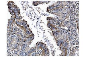 IHC analysis of GSDMD using anti-GSDMD antibody (ABIN7599433). (GSDMD anticorps  (AA 1-484))