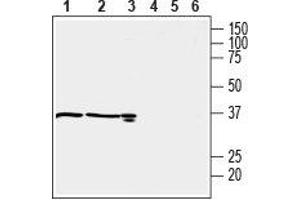 Western blot analysis of mouse kidney (lanes 1 and 4), rat kidney (lanes 2 and 5) (1:600) and rat testis (lanes 3 and 6) (1:200) lysates: - 1-3. (OXGR1 anticorps  (C-Term, Intracellular))