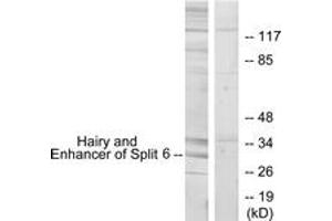 Western blot analysis of extracts from HeLa cells, using HES6 Antibody. (HES6 anticorps  (AA 1-50))