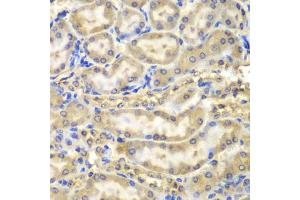 Immunohistochemistry of paraffin-embedded mouse kidney using MBP antibody (ABIN5970825) at dilution of 1/200 (40x lens). (MBP anticorps)