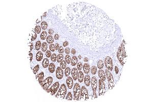 colon descendens mucosa (Recombinant Villin 1 anticorps  (AA 600-700))