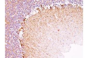 Formalin-fixed, paraffin-embedded human cerebellum stained with Neurofilament antibody (NR-4). (Neurofilament anticorps)