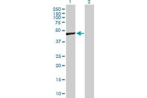Western Blot analysis of WBSCR16 expression in transfected 293T cell line by WBSCR16 MaxPab polyclonal antibody. (WBSCR16 anticorps  (AA 1-464))
