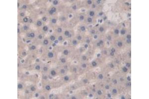 IHC-P analysis of Rat Tissue, with DAB staining. (Vitamin D-Binding Protein anticorps  (AA 395-475))