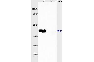 Lane 1: human colon carcinoma lysates Lane 2: rat lung lysates probed with Anti CD33 Polyclonal Antibody, Unconjugated (ABIN687607) at 1:200 in 4 °C.