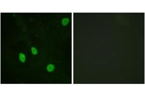 Immunofluorescence analysis of HeLa cells, using Cyclin H (Ab-315) Antibody. (Cyclin H anticorps  (AA 274-323))