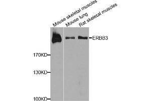 Western blot analysis of extracts of various cell lines, using ERBB3 antibody. (ERBB3 anticorps)