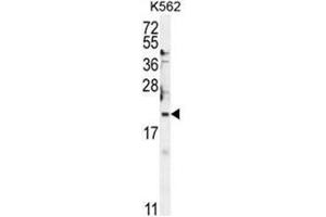 BTG2 Antibody (N-term) western blot analysis in K562 cell line lysates (35µg/lane). (BTG2 anticorps  (N-Term))