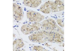 Immunohistochemistry of paraffin-embedded human stomach using MTERFD3 antibody at dilution of 1:100 (x40 lens).