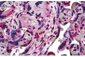 Human Placenta: Formalin-Fixed, Paraffin-Embedded (FFPE) (RBX1 anticorps  (C-Term))