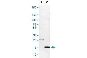 Western Blot analysis of Lane 1: NIH-3T3 cell lysate (mouse embryonic fibroblast cells) and Lane 2: NBT-II cell lysate (Wistar rat bladder tumor cells) with DNAL4 polyclonal antibody . (DNAL4 anticorps)