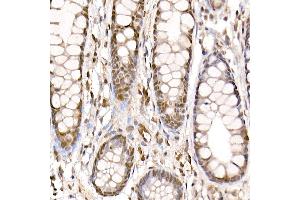 Immunohistochemistry of paraffin-embedded human colon using [KO Validated] PRMT4/C Rabbit pAb (ABIN1682307, ABIN3015886, ABIN3015887 and ABIN6219468) at dilution of 1:25 (40x lens).