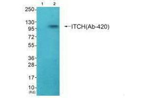 Western blot analysis of extracts from HepG2 cells (Lane 2), using ITCH (Ab-420) antiobdy. (ITCH anticorps  (Tyr420))