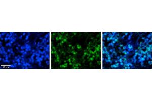 Rabbit Anti-HSPA8 Antibody     Formalin Fixed Paraffin Embedded Tissue: Human Pineal Tissue  Observed Staining: Nuclear in pinealocytes  Primary Antibody Concentration: 1:100  Secondary Antibody: Donkey anti-Rabbit-Cy3  Secondary Antibody Concentration: 1:200  Magnification: 20X  Exposure Time: 0.