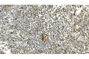 IHC analysis of Carbonic Anhydrase 13/CA13 using anti-Carbonic Anhydrase 13/CA13 antibody (ABIN7603164). (CA13 anticorps  (N-Term))