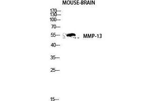 Western Blot (WB) analysis of Mouse Brain lysis using MMP-13 antibody. (MMP13 anticorps  (N-Term))