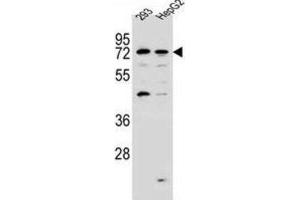 Western Blotting (WB) image for anti-GTPase, IMAP Family Member 8 (GIMAP8) antibody (ABIN2997226)