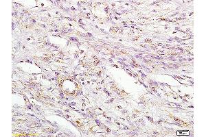 L1 rat kidney lysates L2 rat brain lysates probed with Anti MIIP Polyclonal Antibody, Unconjugated (ABIN758681) at 1:200 in 4 °C. (MIIP anticorps  (AA 251-350))