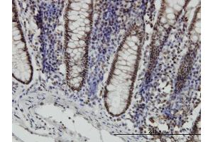 Immunoperoxidase of monoclonal antibody to STAT6 on formalin-fixed paraffin-embedded human colon.