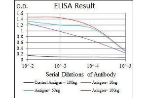 Black line: Control Antigen (100 ng), Purple line: Antigen(10 ng), Blue line: Antigen (50 ng), Red line: Antigen (100 ng),