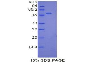 SDS-PAGE analysis of Pig Erythropoietin Protein. (EPO Protéine)