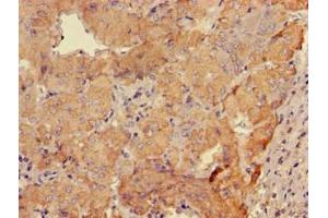 Immunohistochemistry of paraffin-embedded human adrenal gland tissue using ABIN7153497 at dilution of 1:100