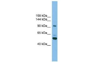 SH3BP4 antibody used at 1 ug/ml to detect target protein. (SH3BP4 anticorps  (N-Term))