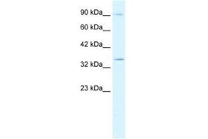 Human Jurkat; WB Suggested Anti-BHLHB5 Antibody Titration: 0. (BHLHE22 anticorps  (N-Term))