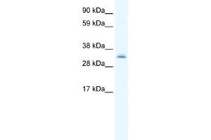 WB Suggested Anti-PDLIM1 Antibody Titration:  0. (PDLIM1 anticorps  (Middle Region))