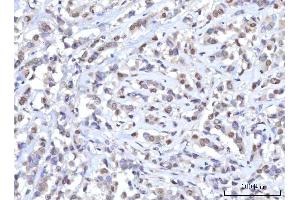 IHC analysis of RANBP2 using anti-RANBP2 antibody (ABIN7602650). (RANBP2 anticorps  (AA 906-2744))