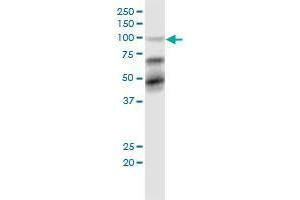 TRIM28 monoclonal antibody (M02), clone 1D11. (KAP1 anticorps  (AA 379-524))