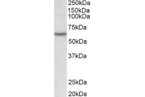 Western Blotting (WB) image for anti-Lymphocyte-Specific Protein tyrosine Kinase (LCK) (AA 39-52) antibody (ABIN1102819) (LCK anticorps  (AA 39-52))