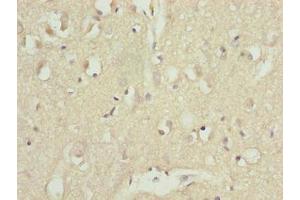 Immunohistochemistry of paraffin-embedded human brain tissue using ABIN7144078 at dilution of 1:100 (CDC26 anticorps  (AA 1-85))
