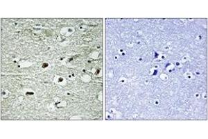 Immunohistochemistry analysis of paraffin-embedded human brain, using hnRNP C1/2 (Phospho-Ser260) Antibody.