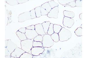 Immunohistochemistry of paraffin-embedded rat skeletal muscle using Dystrophin Rabbit mAb (ABIN7266871) at dilution of 1:100 (40x lens). (Dystrophin anticorps)