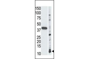 Image no. 1 for anti-Small Ubiquitin Related Modifier Protein 1 (SUMO1) antibody (ABIN356806) (SUMO1 anticorps)