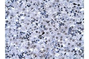 FOXG1A antibody was used for immunohistochemistry at a concentration of 4-8 ug/ml to stain Hepatocyte (arrows) in Human Liver.