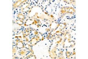 Immunohistochemistry of paraffin embedded mouse kidney using Dmac2l (ABIN7073751) at dilution of 1: 650 (400x lens) (Distal Membrane Arm Assembly Complex 2 L Homeolog (DMAC2.L) anticorps)