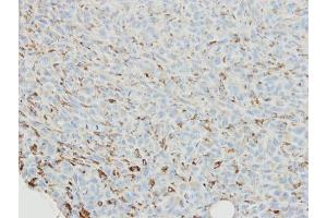 IHC-P Image Immunohistochemical analysis of paraffin-embedded MDAMB231 xenograft, using SNX18, antibody at 1:500 dilution. (SNX18 anticorps  (C-Term))