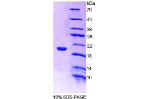 SDS-PAGE (SDS) image for Cellular Repressor of E1A-Stimulated Genes 1 (CREG1) (AA 75-220) protein (His tag) (ABIN6236507)