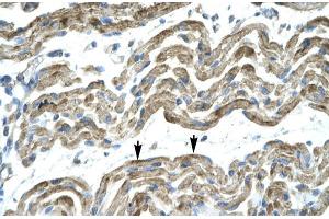 Human Muscle; HumanMuscle; C13ORF8 antibody - middle region in Human Muscle cells using Immunohistochemistry (ZNF828 anticorps  (Middle Region))