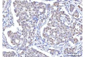 IHC analysis of RANBP2 using anti-RANBP2 antibody (ABIN7602650). (RANBP2 anticorps  (AA 906-2744))