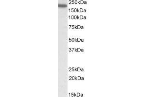 ABIN571017 (0. (ITGAL anticorps  (Internal Region))