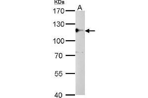 WB Image CYLD antibody detects CYLD protein by Western blot analysis.